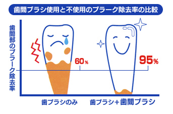 歯間ブラシ使用と不使用のプラーク除去率の比較